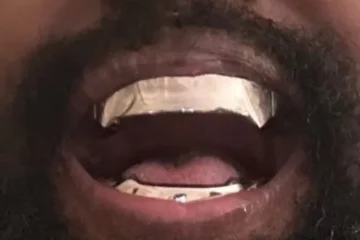 Kanye West showt nieuwe grill, geïnspireerd door James Bond Schurk Jaws